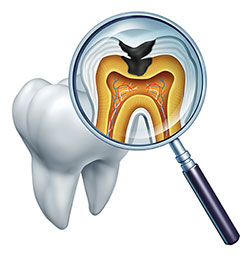 Calverton Dental Care | Implant Dentistry, Dental Fillings and Night Guards