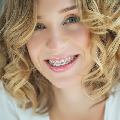 Calverton Dental Care | Veneers, Sports Mouthguards and Teeth Whitening