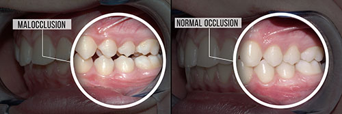 Calverton Dental Care | Sedation Dentistry, Dental Sealants and Teeth Whitening