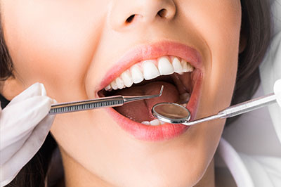Calverton Dental Care | Preventative Program, Snoring Appliances and Teeth Whitening